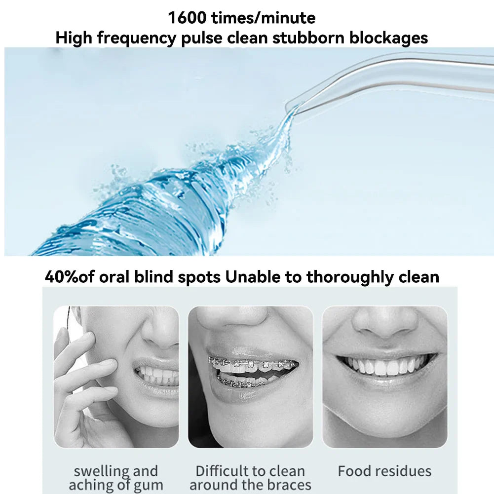 FreshSmile Portable Water Flosser
