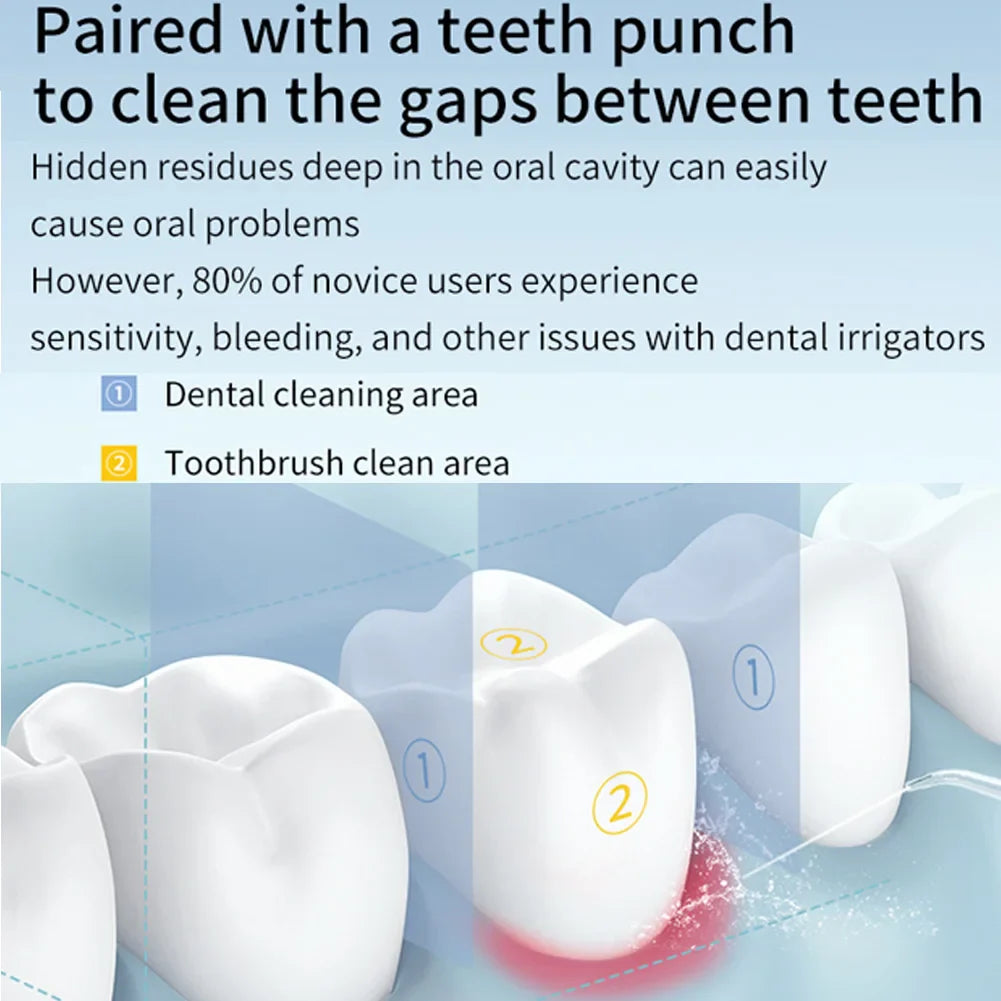 FreshSmile Portable Water Flosser